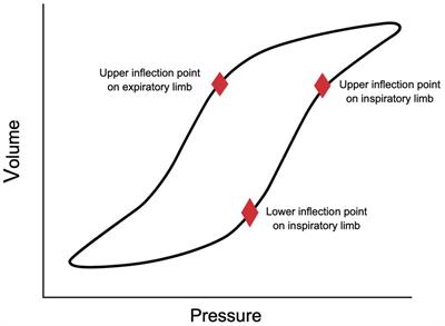 Setting the optimal positive end-expiratory pressure: a narrative review